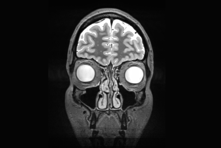 a skull with a light inside